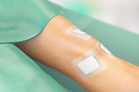 Sorbact-sidos polven päällä artroskopian jälkeen.