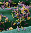 illustration of microbes on sorbact surface